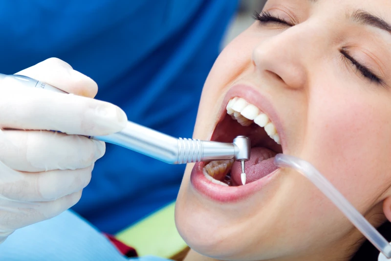 همه چیز در مورد کامپوزیت دندان - کاربرد‌ها